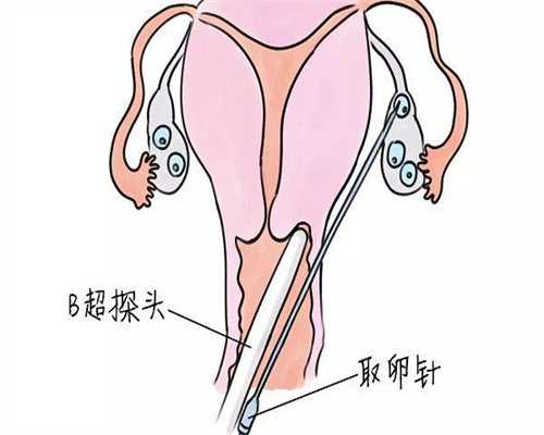 重庆正规的助孕机构！重庆助产学校有哪些！