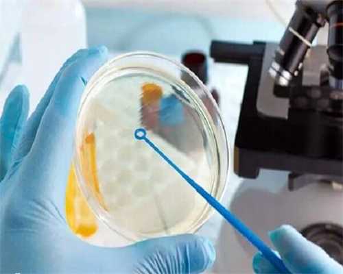 多囊卵巢综合症怎么减肥？如何进行有效调理？