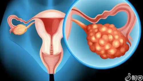 排卵不好的做代生机构客服电话成功率大吗