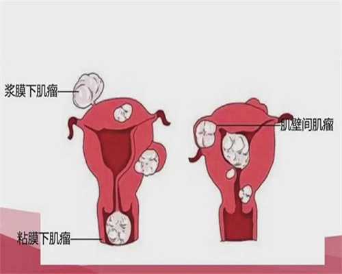 试管婴儿胎停两次了会怎么样？试管胎停2次该怎么办？